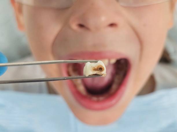 Best Emergency Pediatric Dentist  in Mary Esther, FL